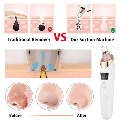 Blemish Remover Kit